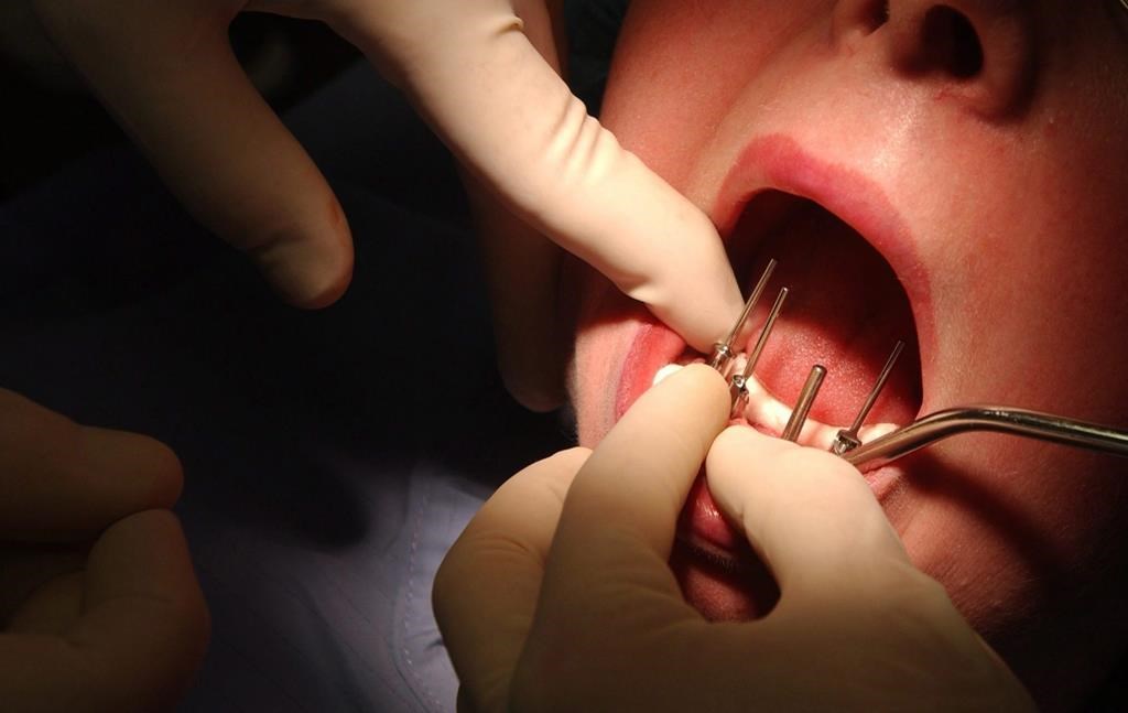 A dentist works on a patient at a dental clinic in this stock image.
