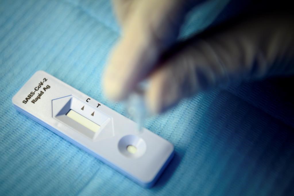 A health worker performs a 'SARS-CoV-2 Rapid Antigen' test in Lausanne, Switzerland, Monday, Nov. 9, 2020. 