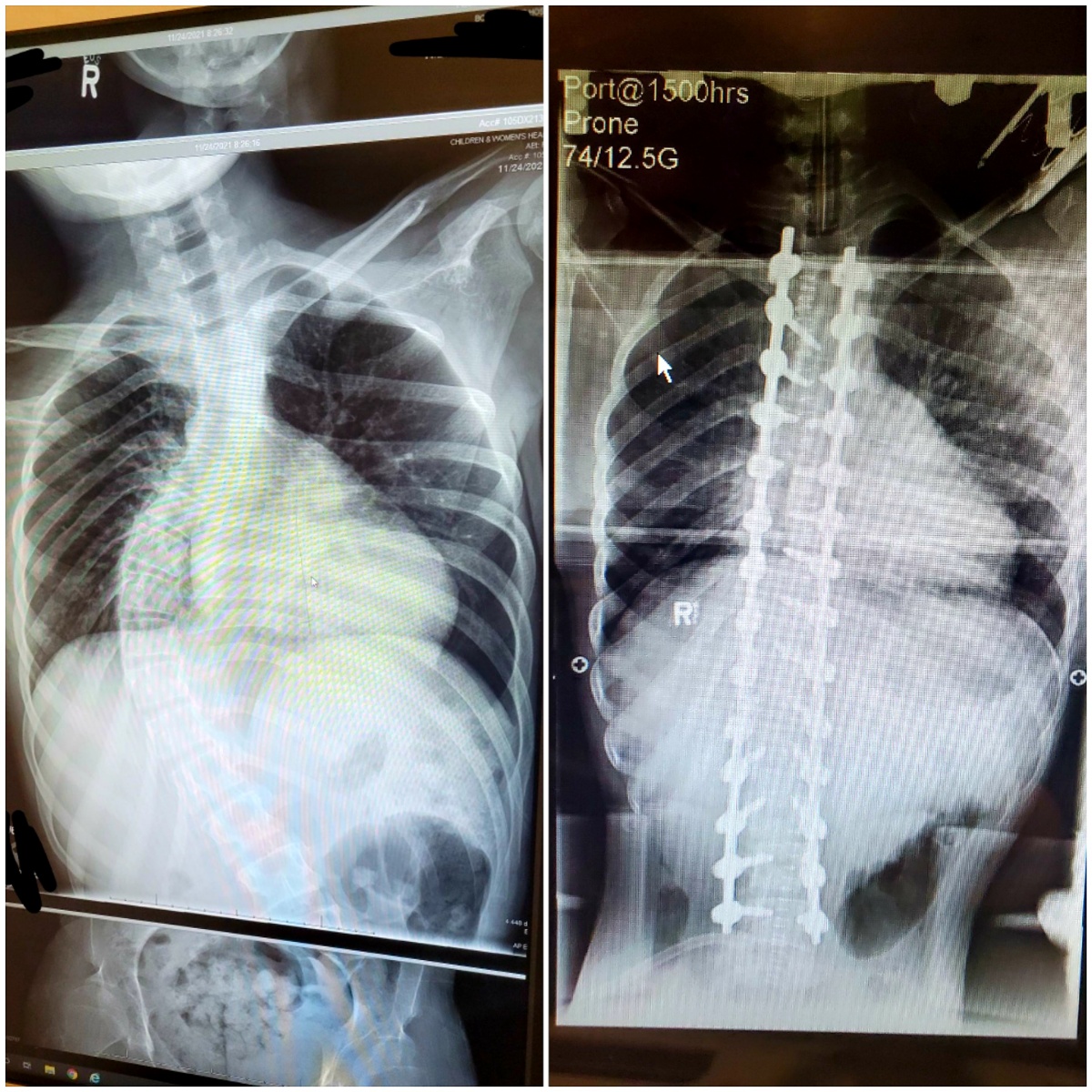 Devin Gallant x-rays