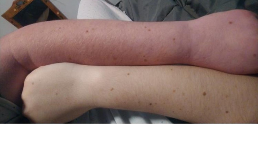 kaytlyn mckibbon tos arms photo