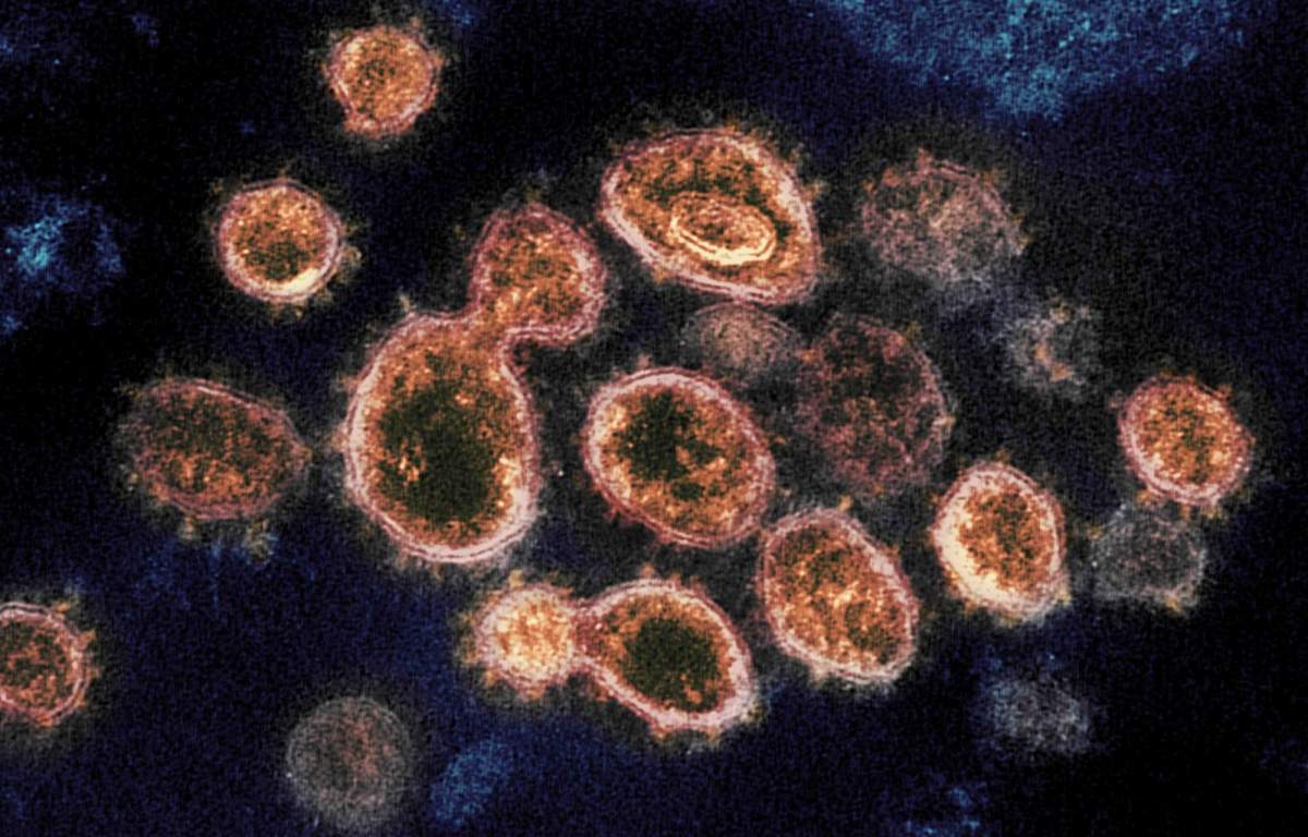 Manitoba officials say the province saw an increase in hospitalizations due to COVID-19 and deaths linked to the virus last week.