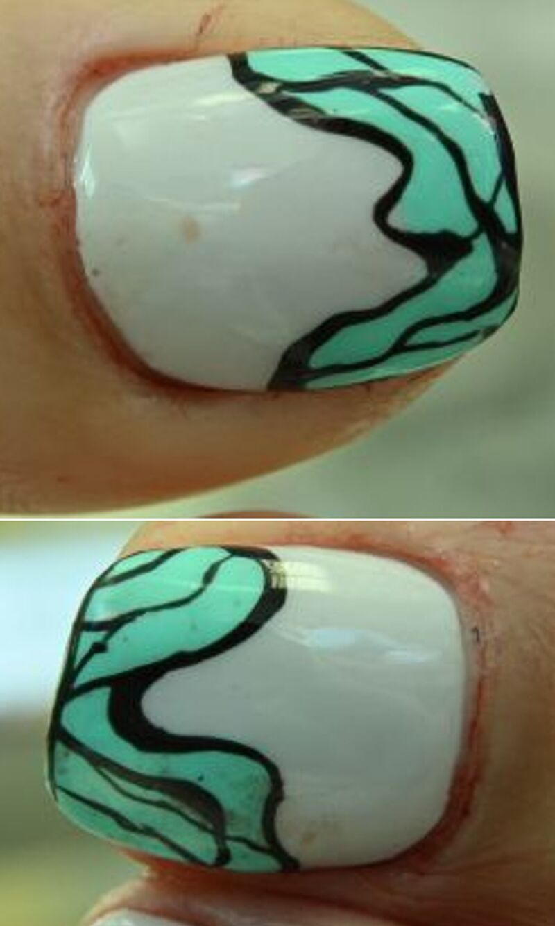 Distinct patterns on finger nails and toe nails.
