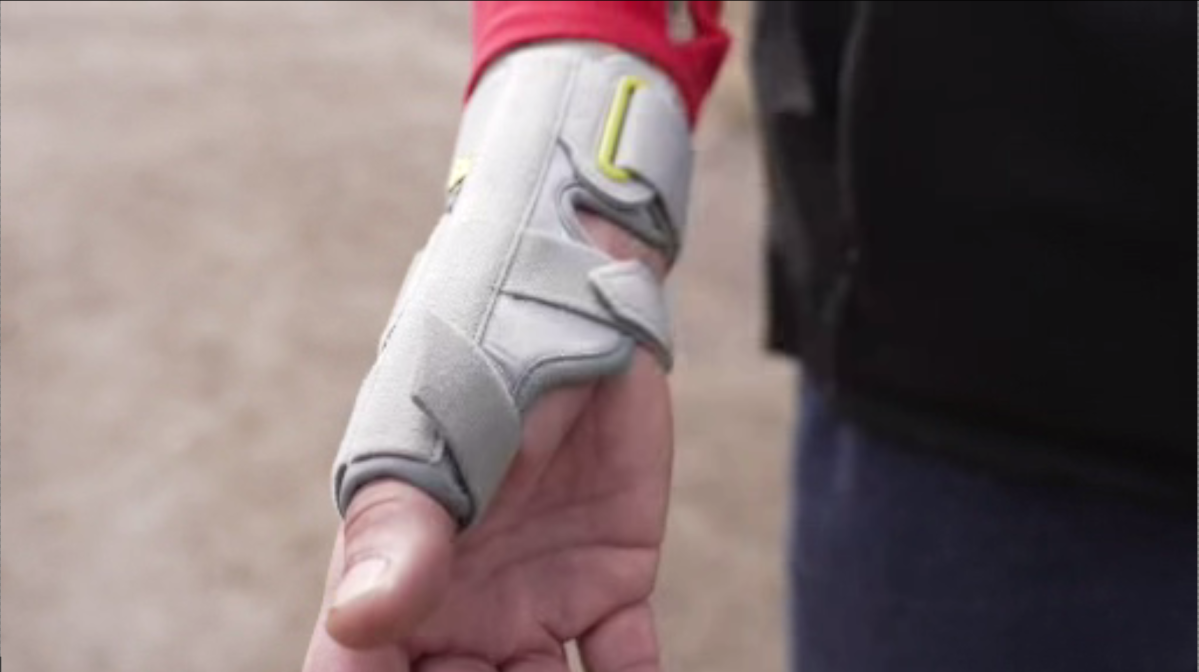 Edgardo Pacheco, 53, claims he suffered a wrist injury following a physical interaction with a Hamilton police officer out front of his residence on the Mounatin in the evening of March 8.