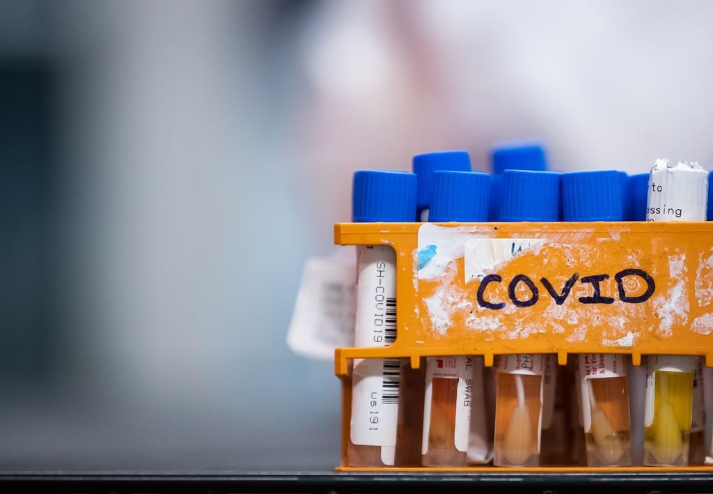 Specimens to be tested for COVID-19 are seen at a lab in Surrey, B.C., on Thursday, March 26, 2020. Two more people in Newfoundland and Labrador have died from COVID-19 as hospitalizations due to the disease reach a new high. THE CANADIAN PRESS/Darryl Dyck.