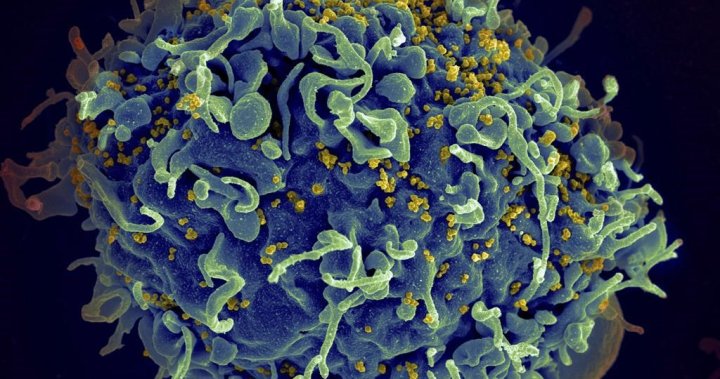 Halifax region records increase in number of people diagnosed with HIV: Public Health
