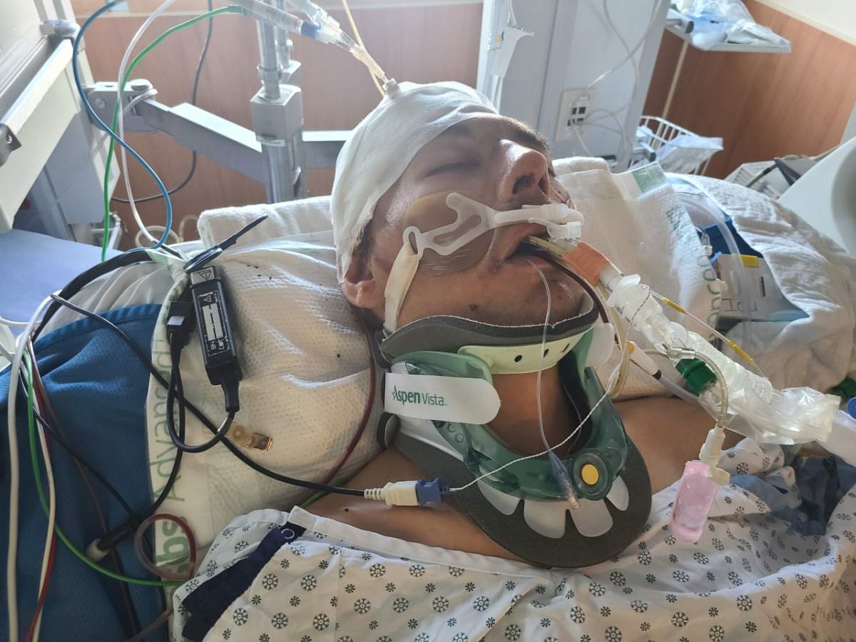 Dale Lylyk in hospital after being struck by a hit-and-run driver in Abbotsford Tuesday night.