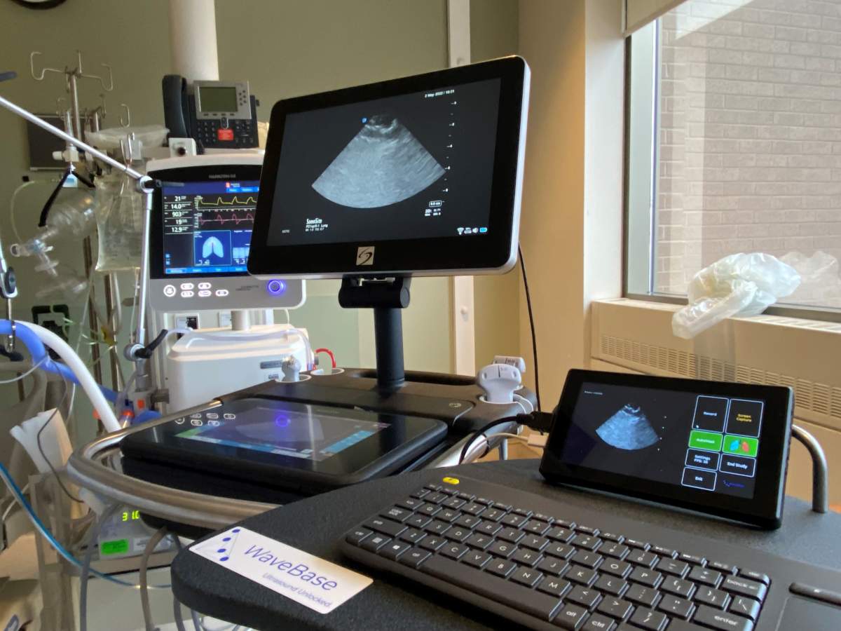 The WaveBase device hooked up to a portable ultrasound machine.