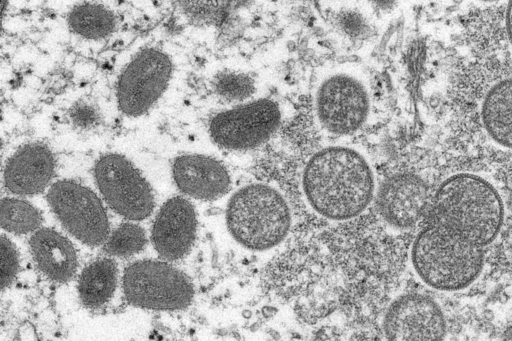 This 2003 electron microscope image made available by the Centers for Disease Control and Prevention shows mature, oval-shaped monkeypox virions, left, and spherical immature virions, right, obtained from a sample of human skin associated with the 2003 prairie dog outbreak. On Wednesday, May 18, 2022, Portuguese health authorities confirmed five cases of monkeypox in young men, marking an unusual outbreak in Europe of a disease typically limited to Africa. (Cynthia S. Goldsmith, Russell Regner/CDC via AP).