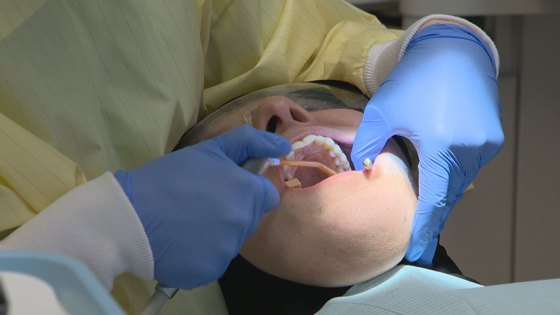 Welcome Hall Mission, McGill to expand dental services for most vulnerable – Montreal
