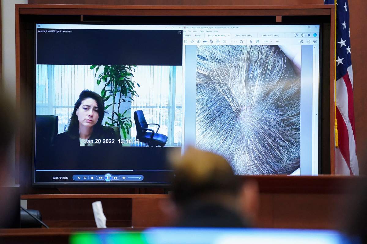 Raquel Pennington testifies during a previously recorded video deposition next to an evidence picture depicting alleged injuries to Amber Heard's scalp during Johnny Depp's defamation trial against his ex-wife Amber Heard at the Fairfax County Circuit Courthouse in Fairfax, Virginia, on May 18, 2022.