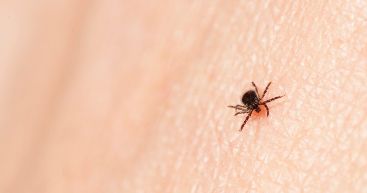 The tick season is here, but experts say there’s no reason for Canadians to be overly worried-nationwide
