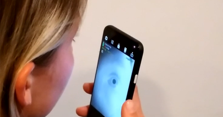 새로운 눈 스캐닝 앱으로 사람들의 알츠하이머병, ADHD를 선별할 수 있습니다: 연구원 – National