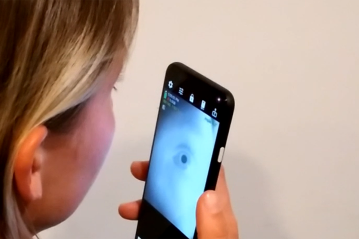 Nieuwe app voor oogscans kan mensen screenen op de ziekte van Alzheimer, ADHD: onderzoekers
