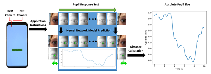 A diagram of the flow from data acquisition to the final data. A user self administers a pupil response test, then the data are collected off-device to compute the distance and pupil diameter. The final result is shown on the far right. Credit: Digital Health Lab