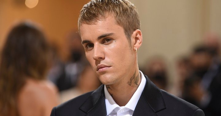 Justin Bieber says he has facial paralysis due to Ramsay Hunt syndrome