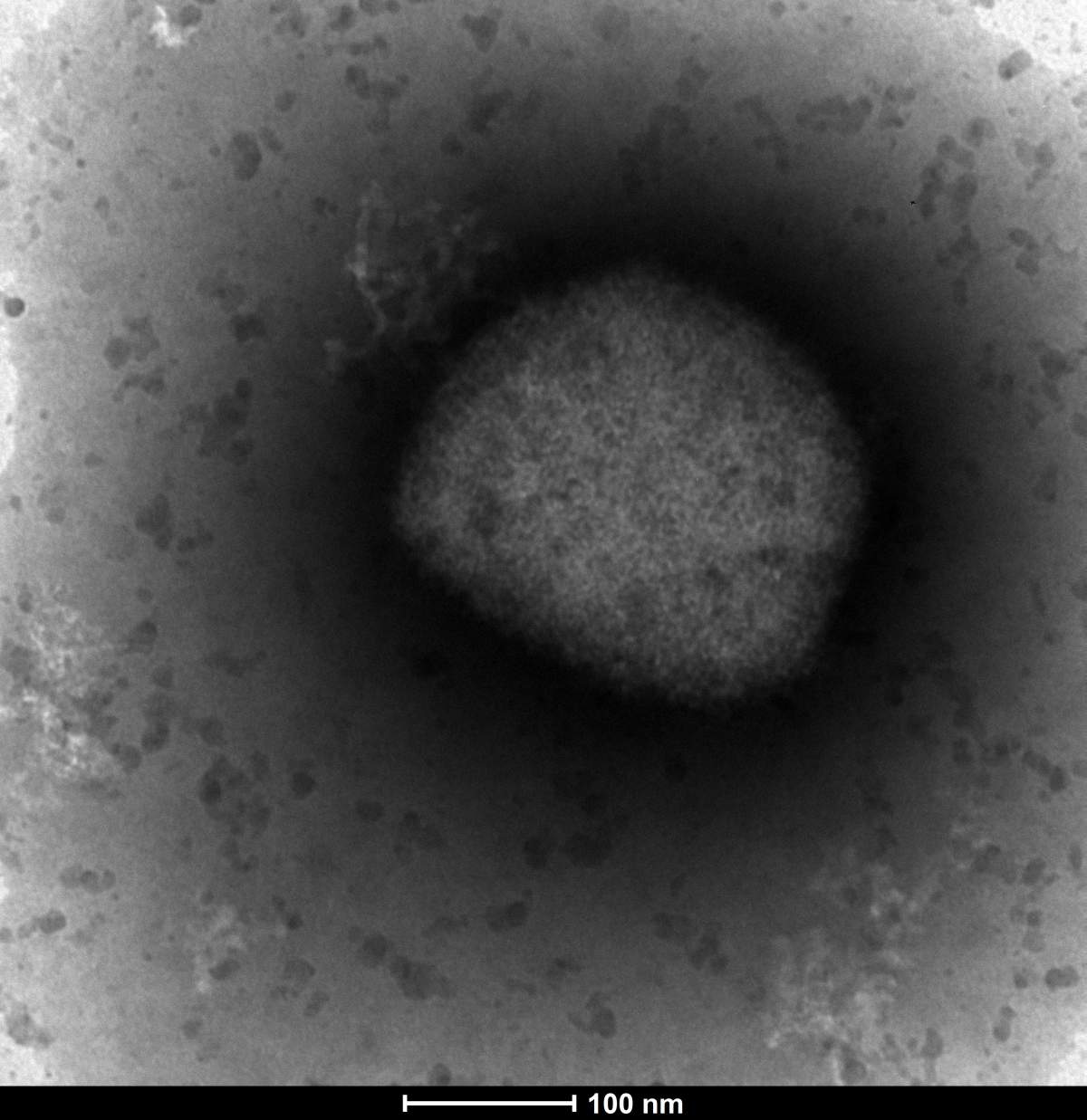 In this photo provided by the Unidad de MicroscopÃ­a ElectrÃ³nica del ISCIII in Madrid, on Thursday May 26, 2022, an electronic microscope image shows the monkeypox virus seen by a team from the Arbovirus Laboratory and the Genomics and Bioinformatics Units of the Carlos III Health Institute (ISCIII) in Madrid. Health authorities in Europe, North America, Israel and Australia have identified more than 100 cases of monkeypox in recent days. (Unidad de MicroscopÃ­a ElectrÃ³nica del ISCIII, via AP).