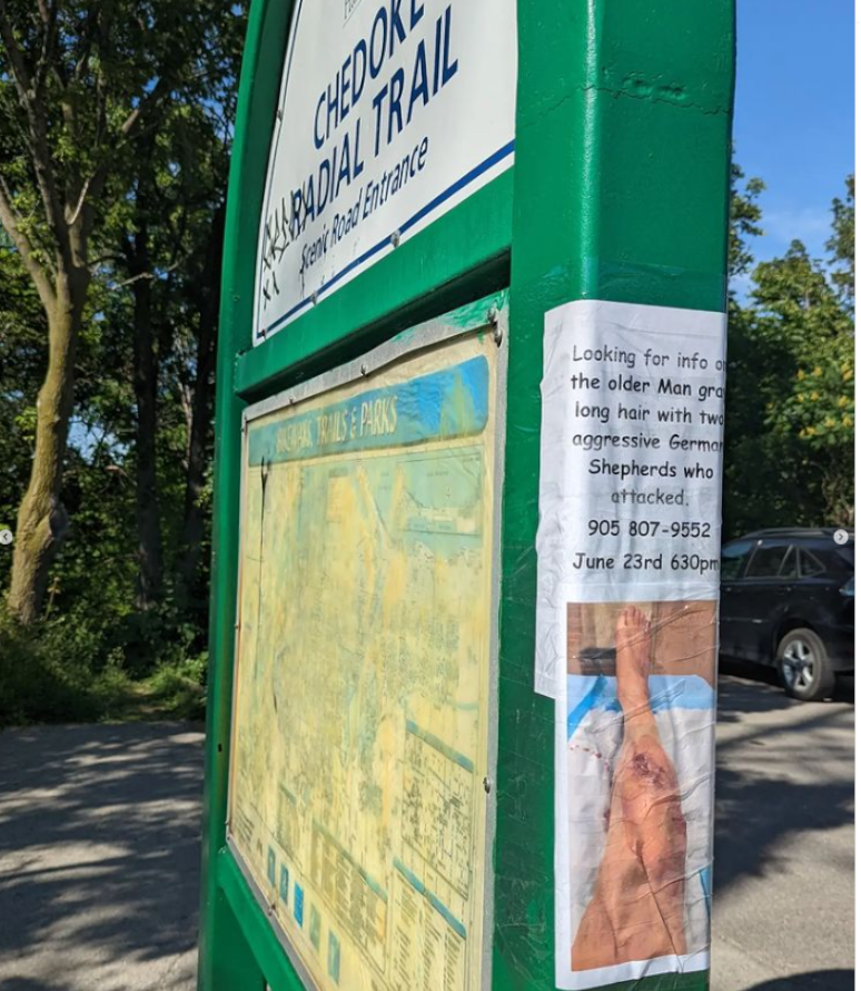 Hamilton residents Tamara Dufour and Marcel Camposilvan say they have received as many as 10 responses a day from concerned trail-goers after putting out the word of Dufour’s leg injury after a dog attack.