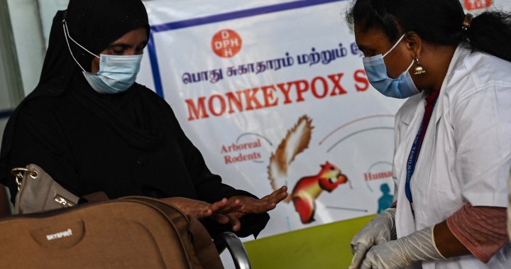 Monkeypox has half of Canadians worried, but most confident in health response: poll