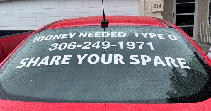 Saskatoon woman hopes message seen on car will help her find kidney donor