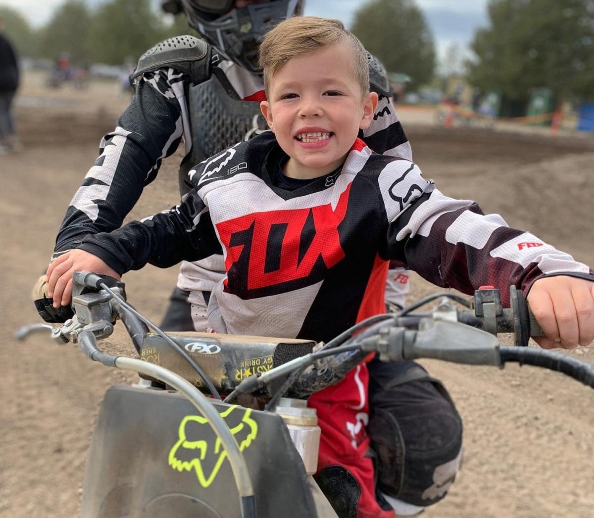 Eight-year-old Nixon Parons of Peterborough suffered extensive facial and head injuries following a dirt bike crash on July 9, 2022 in Burnt River, Ont.,.