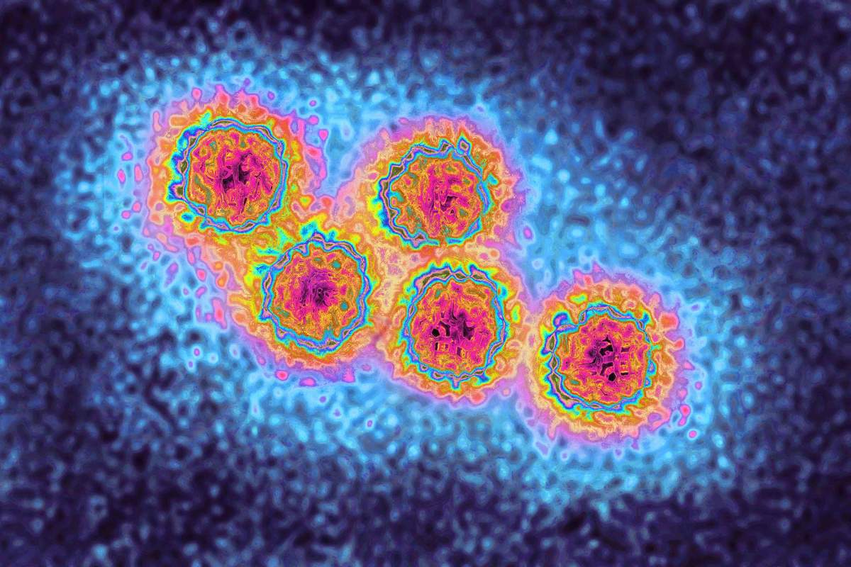 Hepatitis A virus (picornavirus). The HAV. almost always causes mild hepatitis. View produced from a transmission electron microscopy image. Viral diameter approximately: 30 nm.