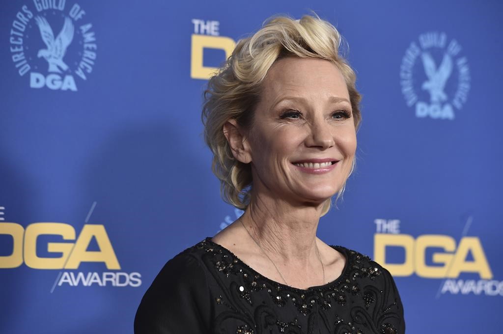 Anne Heche post-mortem outcomes: Actor not intoxicated on the time of dying – Nationwide