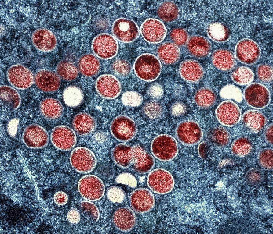 Monkeypox virus, under a microscope