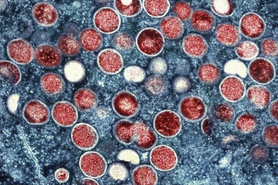 Monkeypox virus, under a microscope