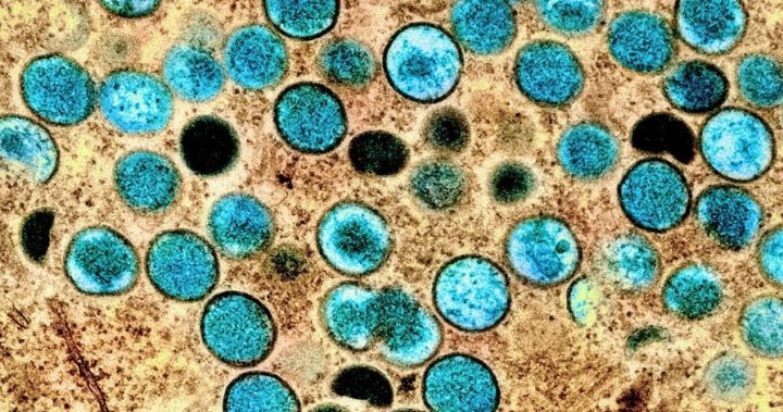 Mpox is still a global public health emergency, WHO declares