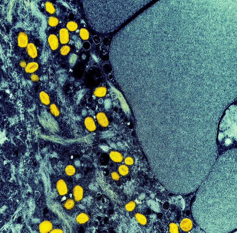 A colourized transmission electron micrograph of monkeypox particles (yellow) found within an infected cell (blue), is shown in a handout photo captured at the NIAID Integrated Research Facility (IRF) in Fort Detrick, Maryland.