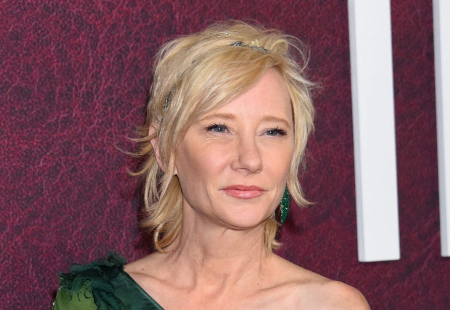 Heche’s Cause Of Death Revealed: Smoke Inhalation & Thermal Injuries