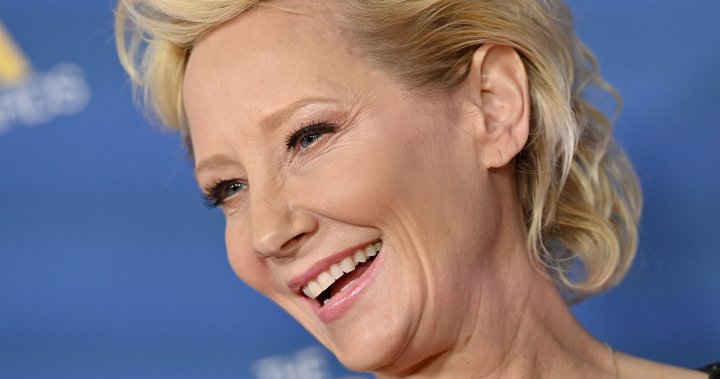 Anne Heche in coma following automobile crash, stays in important situation – Nationwide