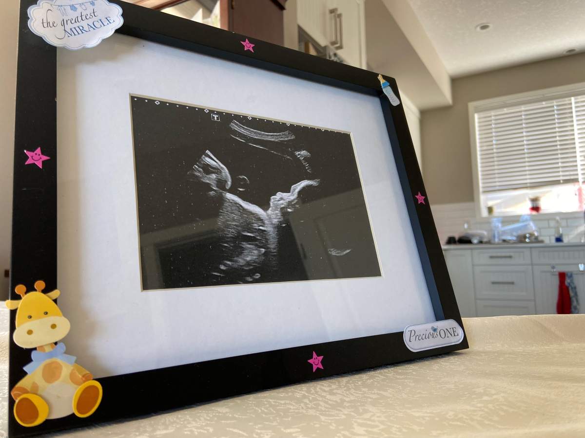 Ultrasound picture of Andrew and Tanya’s baby.