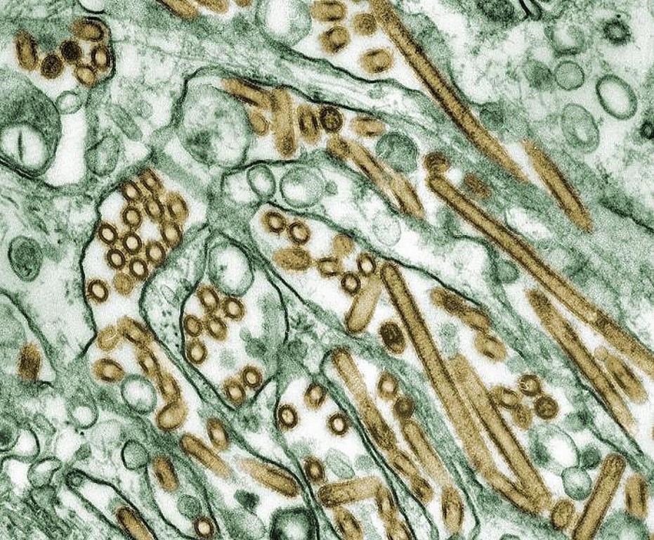 Colorized transmission electron micrograph of Avian influenza A H5N1 viruses (seen in gold) grown in MDCK cells (seen in green) as shown in this undated handout photo.