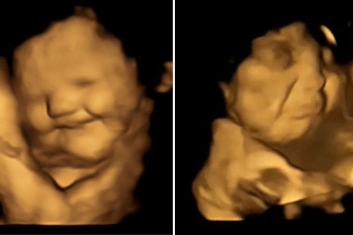 Fetuses smile for carrots but frown for kale, new ultrasound study finds