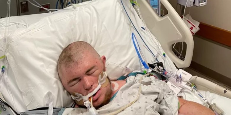 Man stung by bees 20,000 times while removing tree branches in Ohio