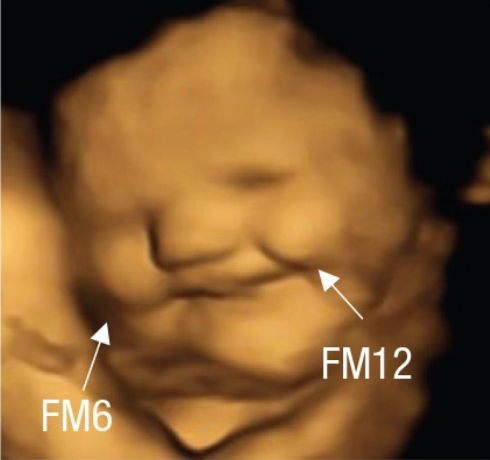 An ultrasound scan of a fetus that appears to be smiling.