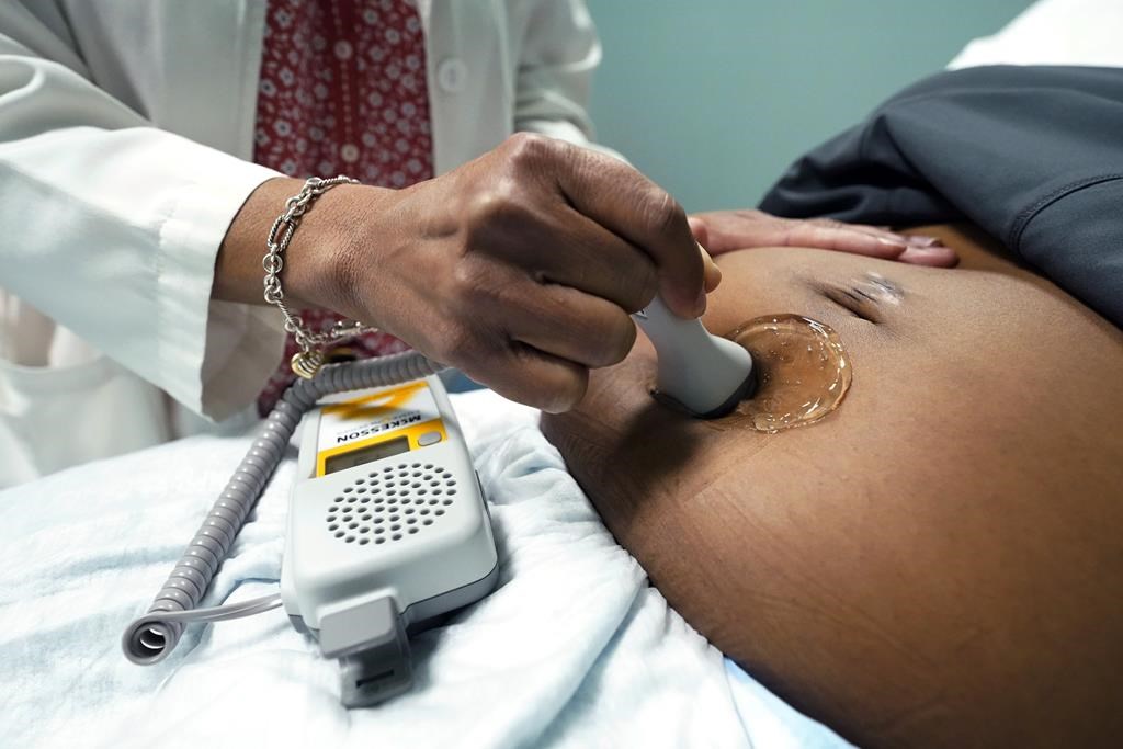 Photo of a doctor checking on a pregnant woman