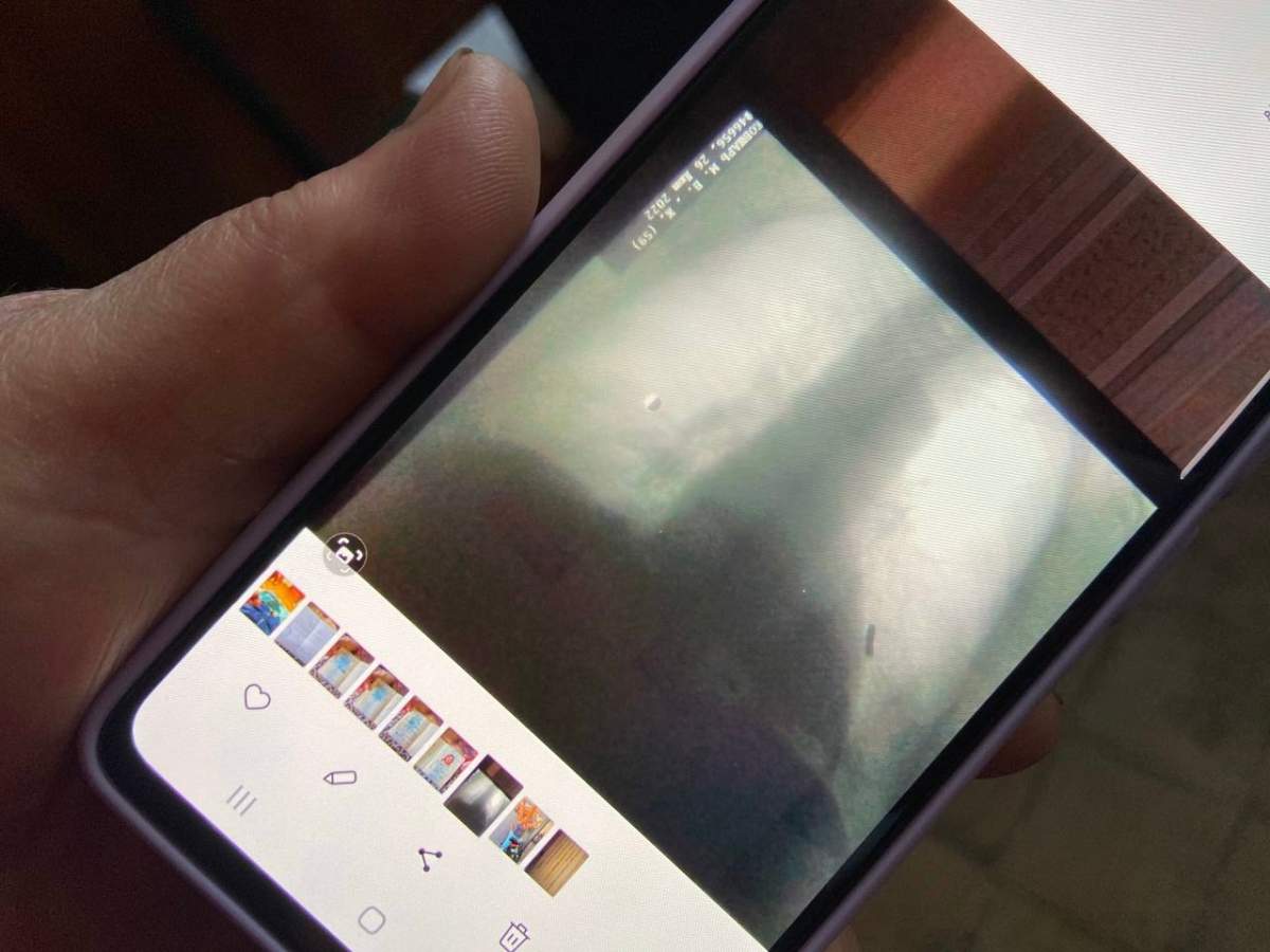 Maria Kivshar, a resident of Novyi Burluk, Ukraine, shows her x-ray, showing the bullet lodged in her lungs after Russian troops opened fire on her car.