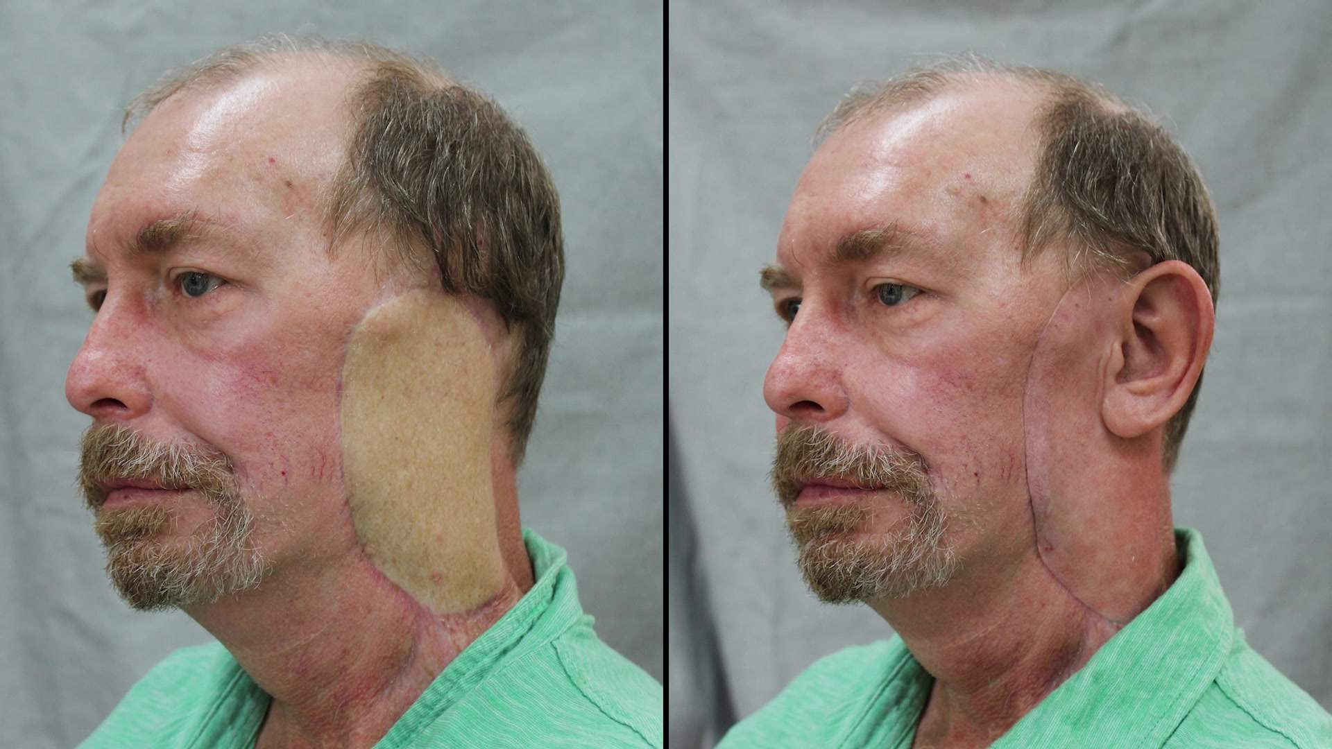 Steve Butler before and after.