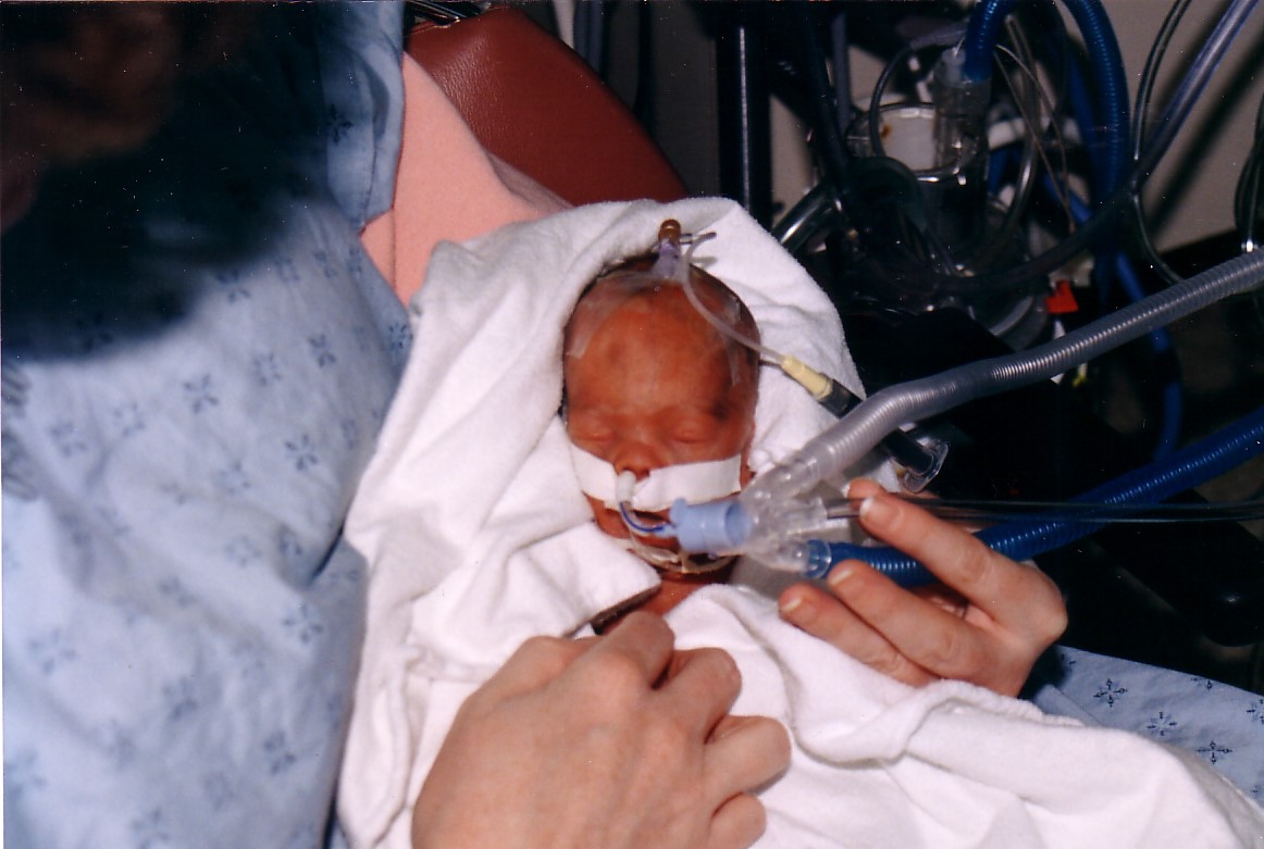 A photo of Steven McLean at three weeks old while he was in the care of Children’s Hospital.