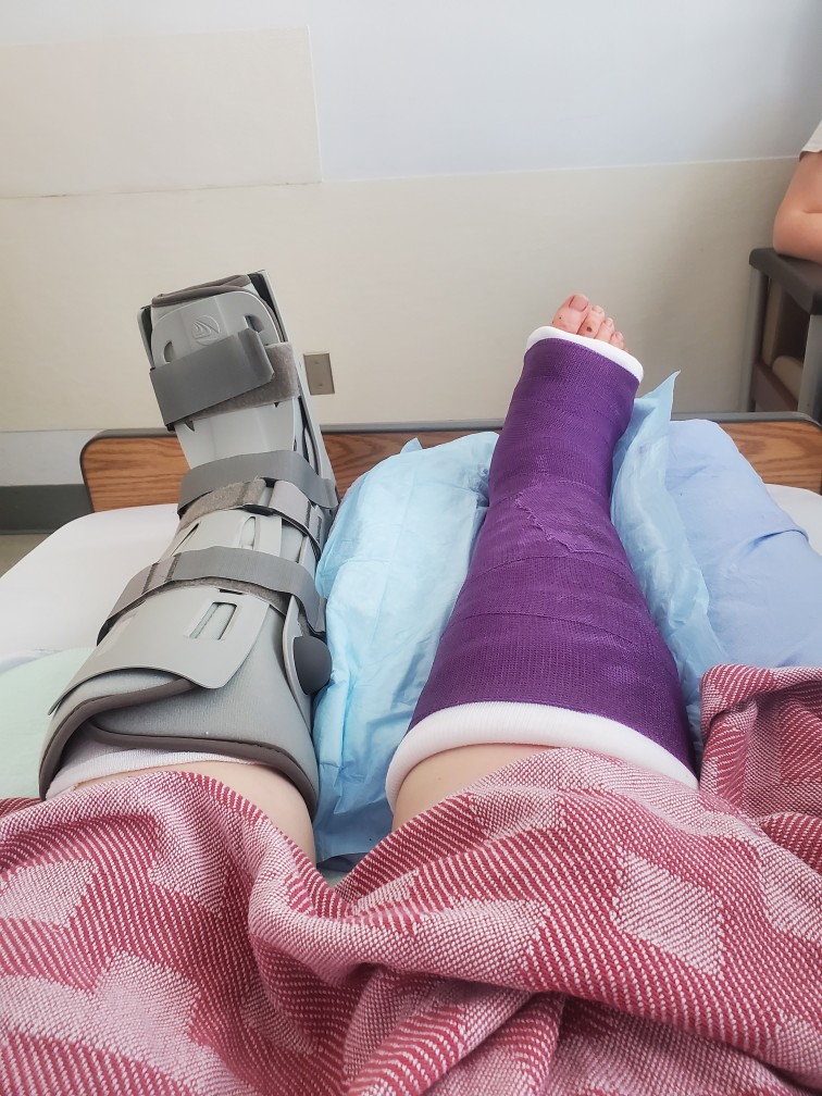 Dawn McKenzie said 28 of her bones were broken after a hit-and-run in Grand Forks, B.C. on June 10, 2022. She is seen here in the hospital after the collision.