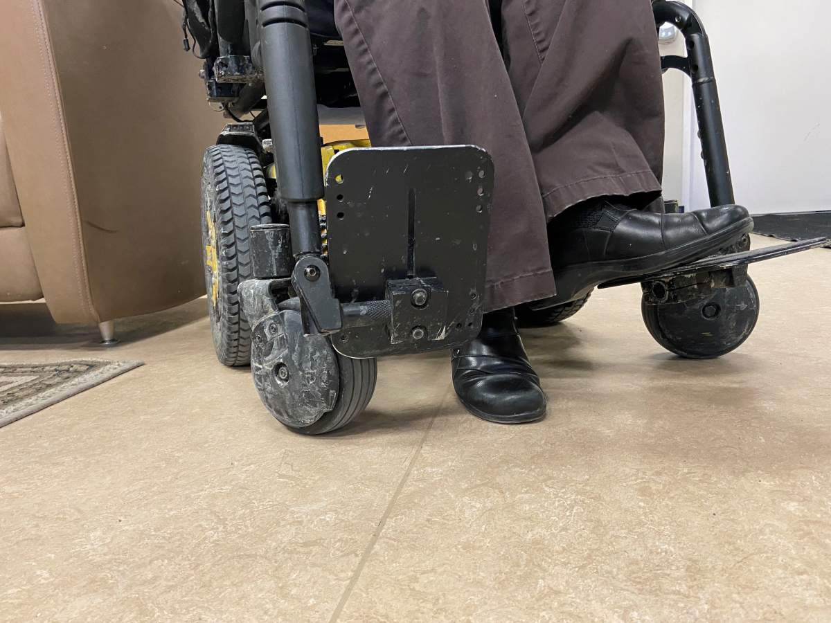 The damaged footrest on her wheelchair.