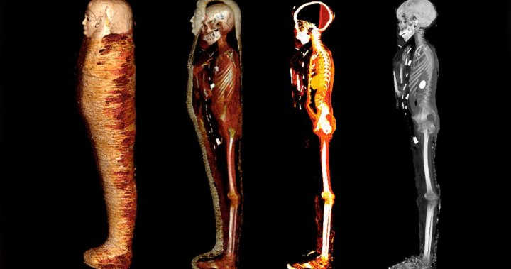 ‘Golden Boy’ mummy digitally unwrapped after 2,300 years, secrets revealed – National | Globalnews.ca
