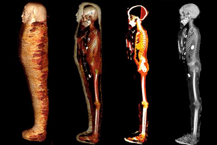 ‘Golden Boy’ mummy digitally unwrapped after 2,300 years, secrets revealed