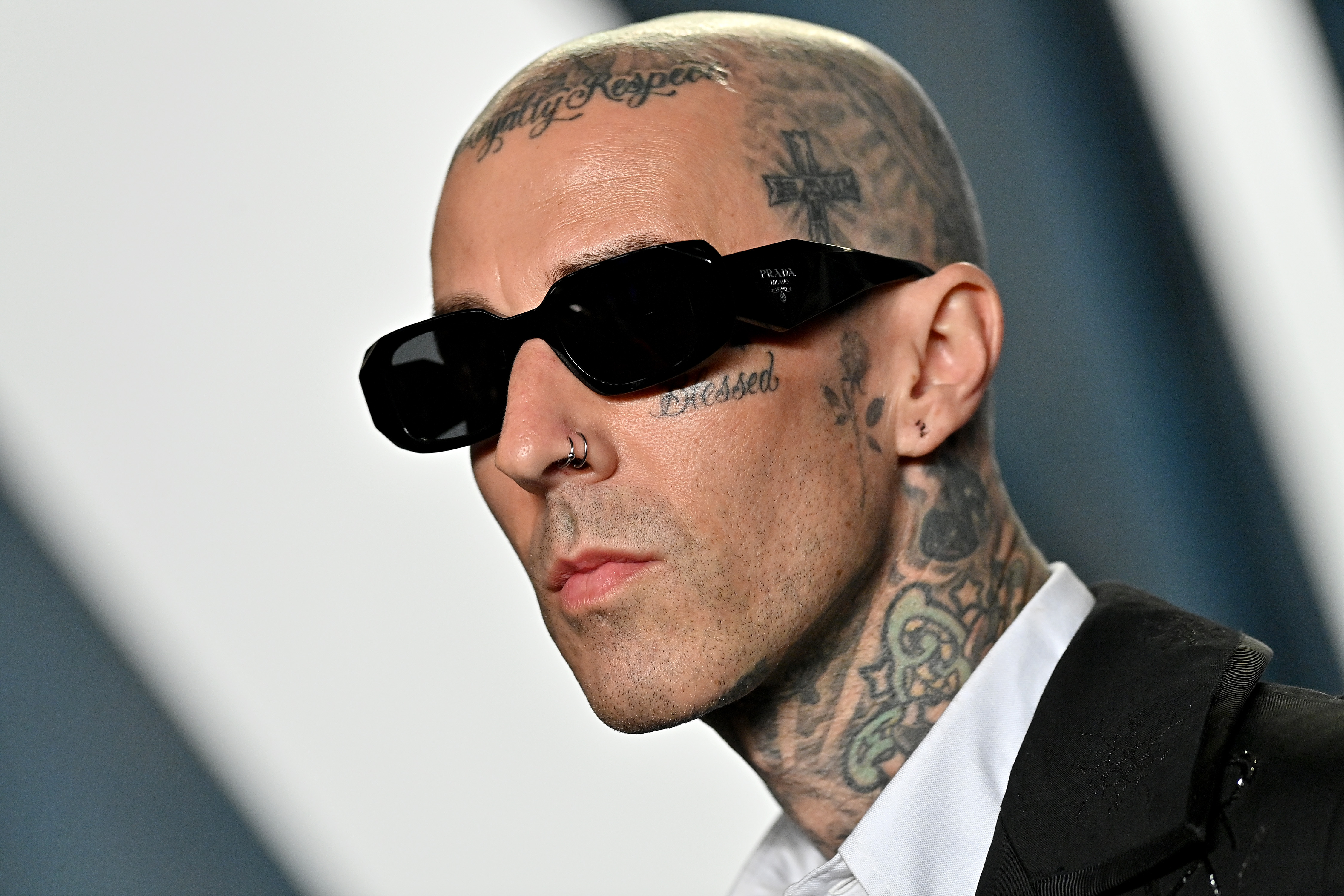 Ongoing History Daily: The worst day of Travis Barker’s life