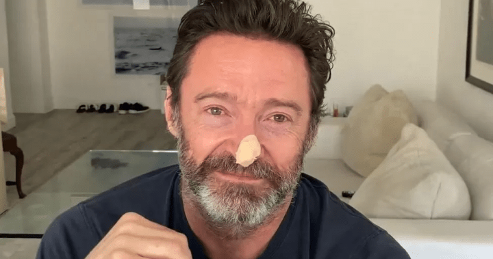Hugh Jackman reveals new cancer scare, urges people to stop tanning – National | Globalnews.ca
