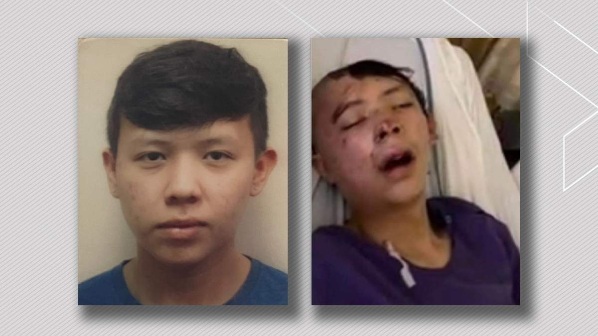 Pacey Dumas was kicked in the head by an Edmonton police officer in December 2020.