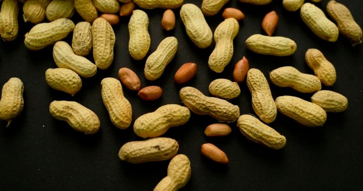 Could a skin patch treat peanut allergies? What new research tells us