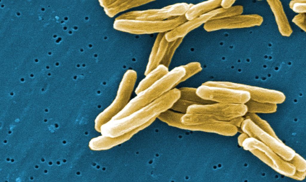 The Mycobacterium tuberculosis bacteria is shown in an electron micrograph image.